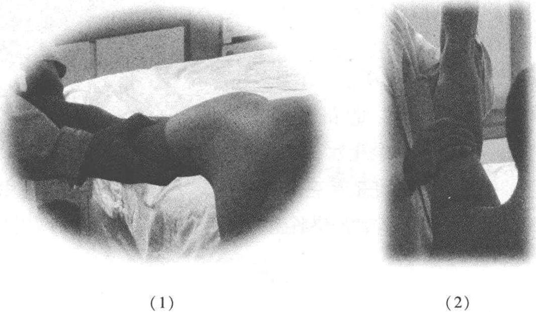 (三) 肩關(guān)節(jié)整復(fù)及經(jīng)筋疏理方法